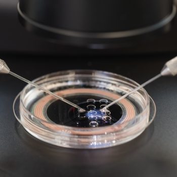 An example of ICSI in action. (Intracytoplasmic Spermatozoa Injection)