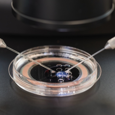 An example of ICSI in action. (Intracytoplasmic Spermatozoa Injection)