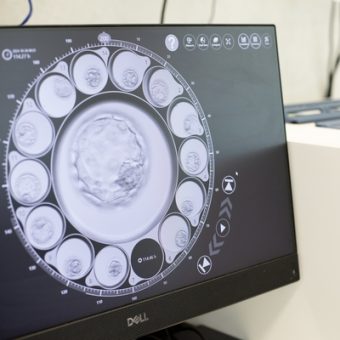 An example of Natural IVF treatment in our South Perth clinic.