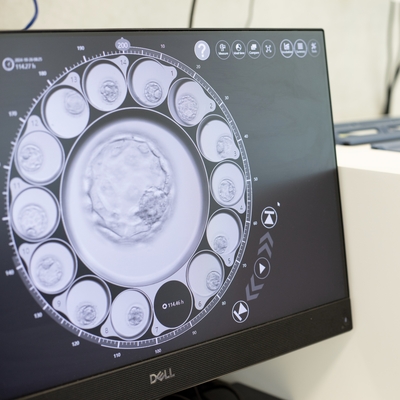 An example of IVF treatment in our South Perth clinic.